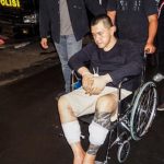 Mata ABG Jakpus Cacat Kena Air Keras Saat Perang Sarung